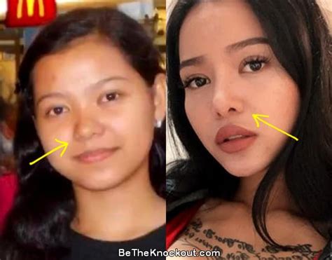 bella poarch before surgery|Bella Poarch Plastic Surgery Comparison Photos